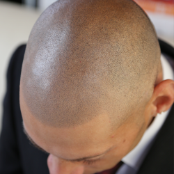 時間の経過とともに、日に日に馴染んでいきます。・ヘアタトゥー画像