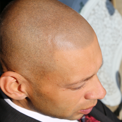 どこからが自毛なのかが分からない精密なドット・ヘアタトゥー画像