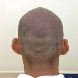 後頭部もカバーできました。・ヘアタトゥー画像