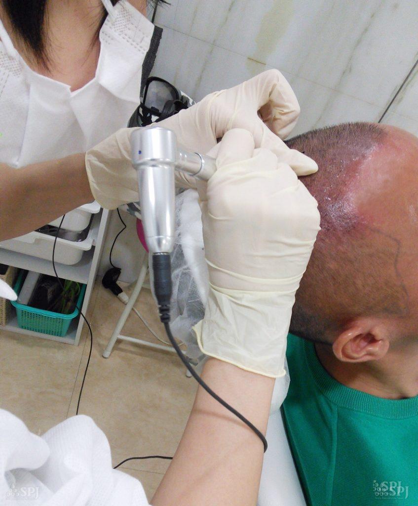 ヘアタトゥー施術中の風景です