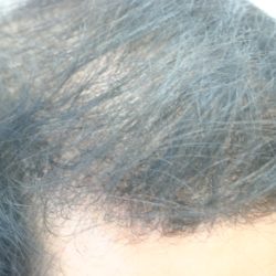 (before)・ヘアタトゥー画像