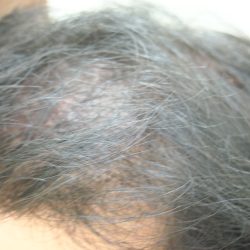 一回目の直後です。・ヘアタトゥー画像