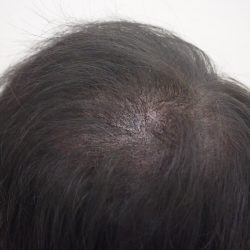 かなりカバーされました。・ヘアタトゥー画像