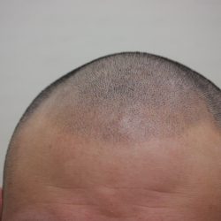 1ヶ月後の状態です。1回目は薄めインクから始めるので、こんな感じです。