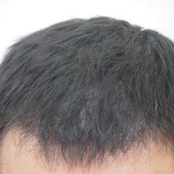 もう風も雨も恐くありません。・ヘアタトゥー画像