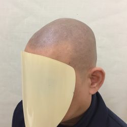 仕上がりの雰囲気は 0.5mm のバリカンで刈った雰囲気が良いと思います。完成後も頭部全体にテカリは感じるので、黒々した濃さは、やり過ぎ感が出てしまう感じがします。・ヘアタトゥー画像