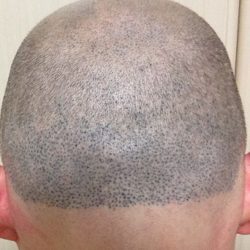 日本人モニターでの実地研修