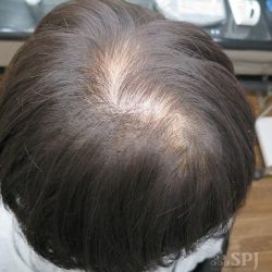 身を捨ててこそ③