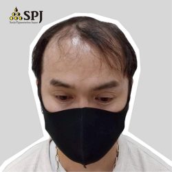 薄毛が進みヘアスタイルに悩んでいる時です。・ヘアタトゥー画像